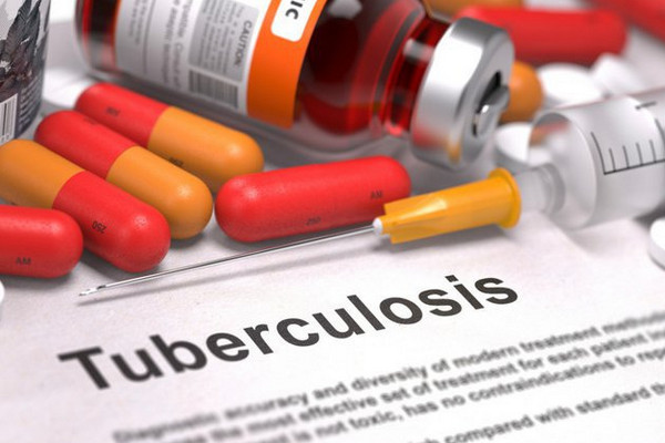 Ilustrasi. (Foto: Shutterstock)