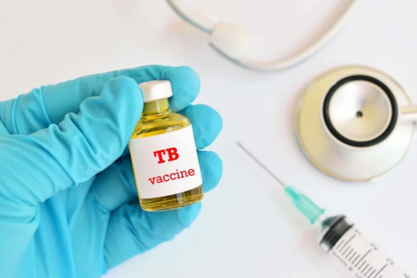 Ilustrasi TBC. (Foto: Getty Images)