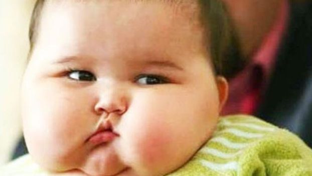 Balita obesitas (Istimewa).